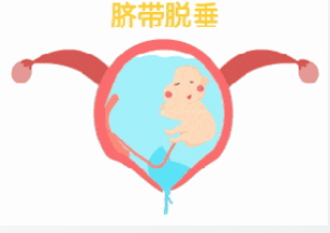 孕妇脐带先露！阜阳市妇女儿童医院妇产急救中心争分夺秒，护佑母婴安全！