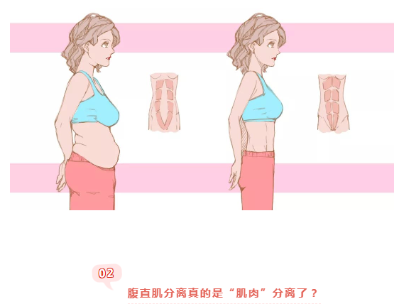 不当产后“大腹婆”,你的腹直肌还好吗?