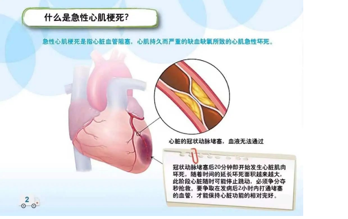 惊心动魄，多学科联动，成功挽回心跳骤停患者生命！