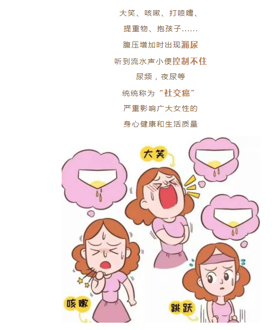 一个不可告人的秘密——尿失禁