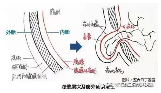 娃娃得了疝气不要怕，阜阳市妇女儿童医院小儿外科来帮您！