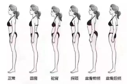 阜阳市妇女儿童医院引进了形体康复新利器——智能三维体态评估,让您遇见更美的自己!