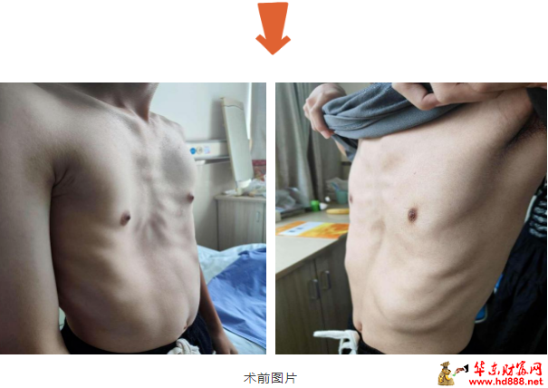 不是瘦而是病，家长们要注意！