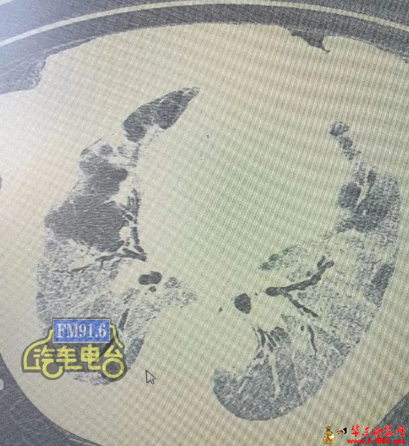 微信图片_20250208185524.png