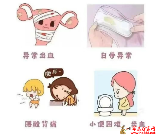 【直播预告】别忽视身体的悄悄提醒：妇科肿瘤早筛指南