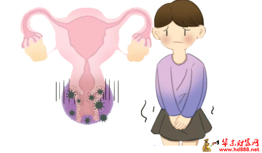 同房后就犯病？女子治疗多年，病因竟藏在&ldquo;先天结构&rdquo;里