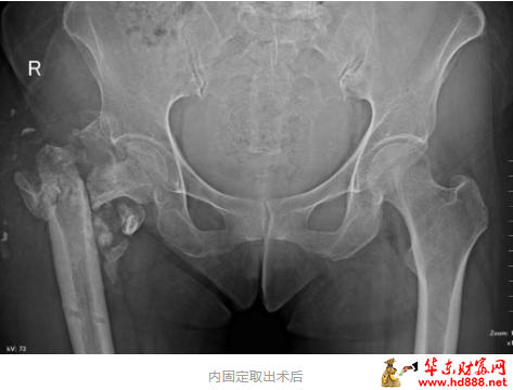 20260117181622295555.png 微信图片_20260117181109_2700_2181.png