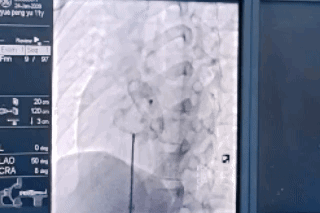 20260131105725893756.gif 640.gif