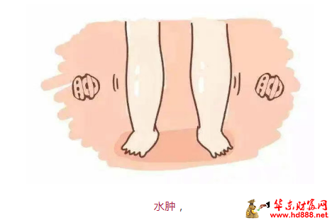 【直播预告】身体水肿，可能是肾脏在报警