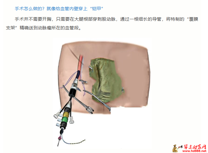 20260613072926333082.png 微信图片_20260613071717_961_1153.png
